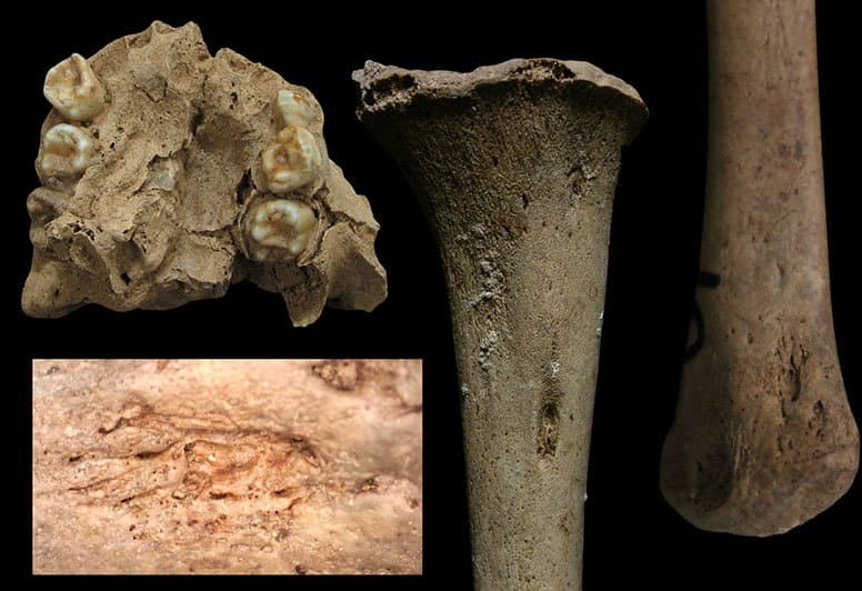 Tarih Öncesi İskelet Keşfi, Eski Bir "Frengi Benzeri" Hastalıkla İlgili Geçmiş Varsayımları Zorluyor