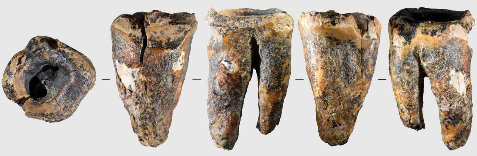 Taş Delme Teknolojisine İlişkin 60.000 Yıllık Kanıtlar, Neandertallerin Antik Diş Hekimliğini Ortaya Çıkarıyor