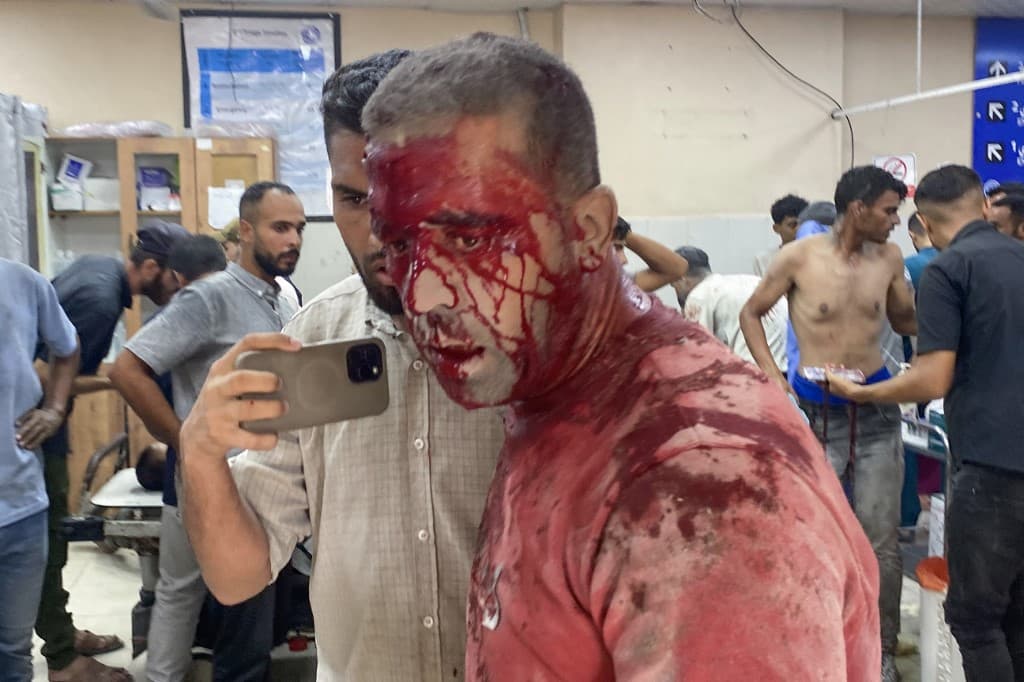 Gaza death toll from Israeli genocide approaches 63,000