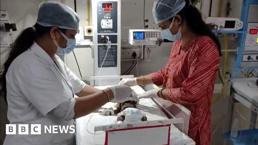 Hindistan'da canlı gömülü yeni doğan bebek hayatı için kavga ediyor