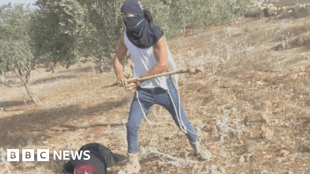 Maskeli İsrailli yerleşimcinin sopayla dövdüğü Filistinli kadın hastaneye kaldırıldı
