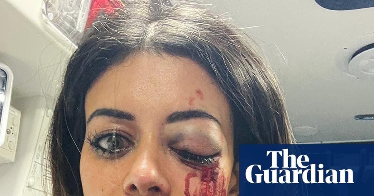 Polis Memuru, Hannah Thomas'ın Sydney'deki Filestin yanlısı protestoda yaralanmasının ardından saldırı ile suçlandı | Yeni Güney Galler
