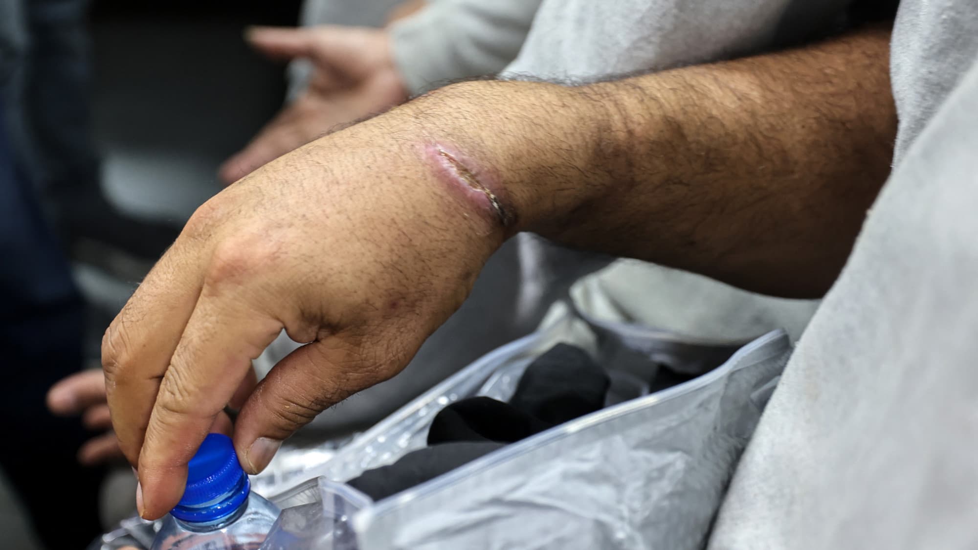Shackled Gaza detainee died in Shin Bet interrogation ‘after falling from height’