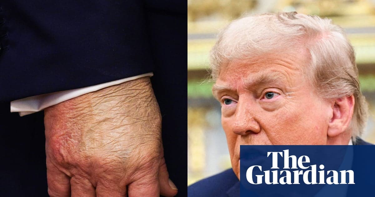 'Trump öldü' ne? Söylentiler şu anki anımız hakkında açıklanıyor | Donald Trump