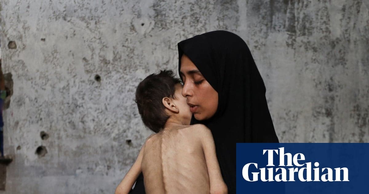 'Yavaşça ölüyoruz, bizi kurtar': Bir hafta korkutucu kilometre taşlarından sonra açlık Gazze'de tutuluyor | Gazze