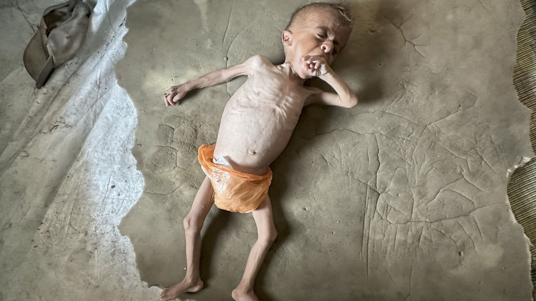 ‘You can see his bones’: In Gaza, parents struggle against child starvation and Israeli war crimes denial